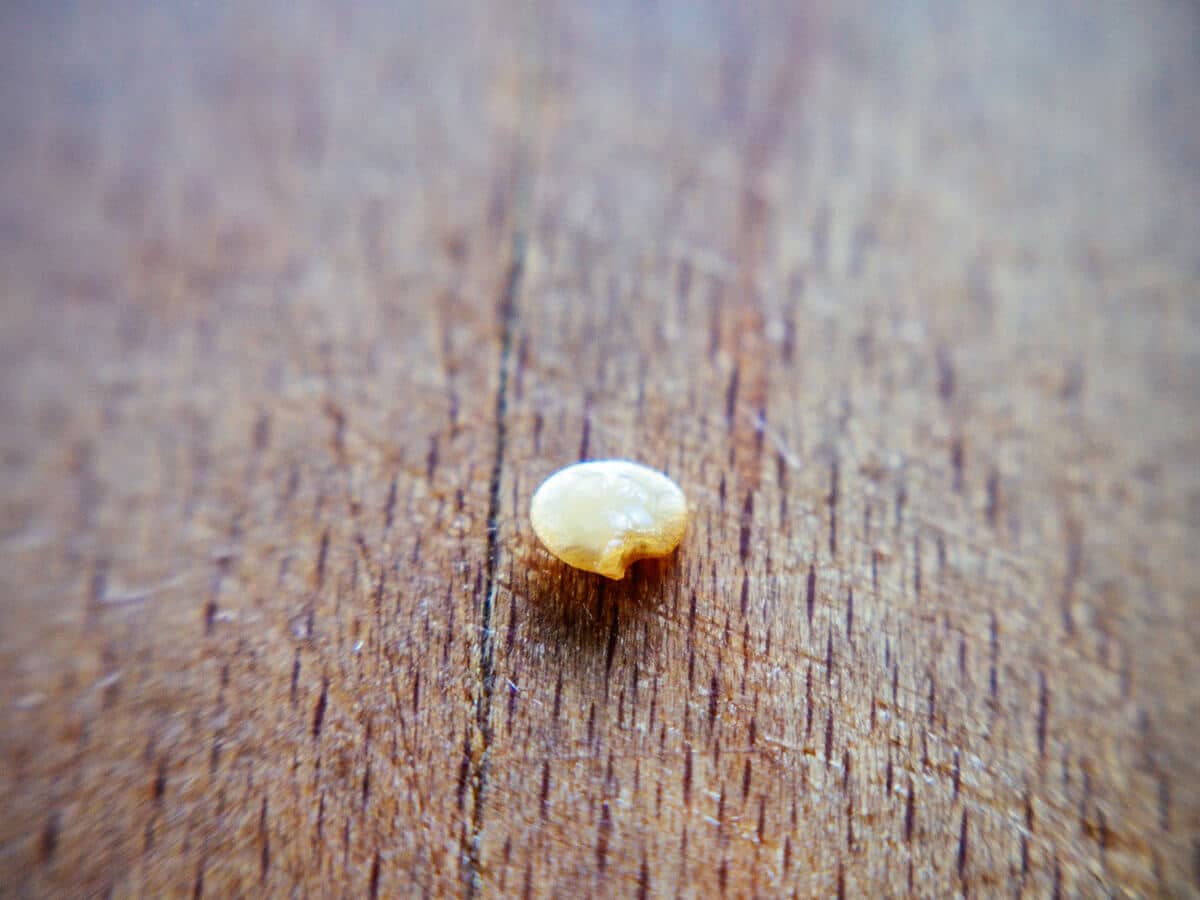 Scar (hilum) on the seed coat